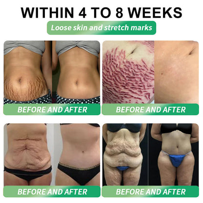 💡𝑶𝒇𝒇𝒊𝒄𝒊𝒂𝒍 𝑺𝒕𝒐𝒓𝒆 | 💯Divifit®🇺🇸𝐺𝐿𝑃-𝟏  𝑺𝒊𝒙-𝒊𝒏-𝑶𝒏𝒆 𝑯𝒆𝒂𝒍𝒕𝒉 𝑺𝒐𝒍𝒖𝒕𝒊𝒐𝒏 𝑶𝒓𝒂𝒍 𝑳𝒊𝒒𝒖𝒊𝒅  (𝐉𝐮𝐬𝐭 𝐨𝐧𝐜𝐞 𝐚 𝐝𝐚𝐲, 𝐯𝐢𝐬𝐢𝐛𝐥𝐞 𝐜𝐡𝐚𝐧𝐠𝐞𝐬 𝐢𝐧 𝟕 𝐝𝐚𝐲𝐬） ✅ 𝐅𝐨𝐫 𝐨𝐛𝐞𝐬𝐢𝐭𝐲, 𝐜𝐚𝐫𝐝𝐢𝐨𝐯𝐚𝐬𝐜𝐮𝐥𝐚𝐫 𝐡𝐞𝐚𝐥𝐭𝐡, 𝐝𝐢𝐚𝐛𝐞𝐭𝐞𝐬, 𝐬𝐥𝐞𝐞𝐩 𝐚𝐩𝐧𝐞𝐚, 𝐆𝐮𝐭 𝐇𝐞𝐚𝐥𝐭𝐡, 𝐣𝐨𝐢𝐧𝐭 𝐢𝐬𝐬𝐮𝐞𝐬, 𝐚𝐧𝐝 𝐦𝐨𝐫𝐞